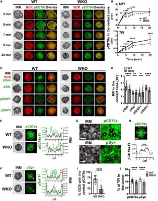 WASp Is Crucial for the Unique Architecture of the Immunological Synapse in Germinal Center B-Cells